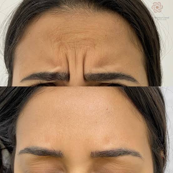Carol Estética — Outro — foto 5